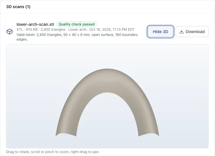 A lower-arch STL file on a case: quality check passed, triangle count and dimensions and the interactive 3D preview. Demo data.